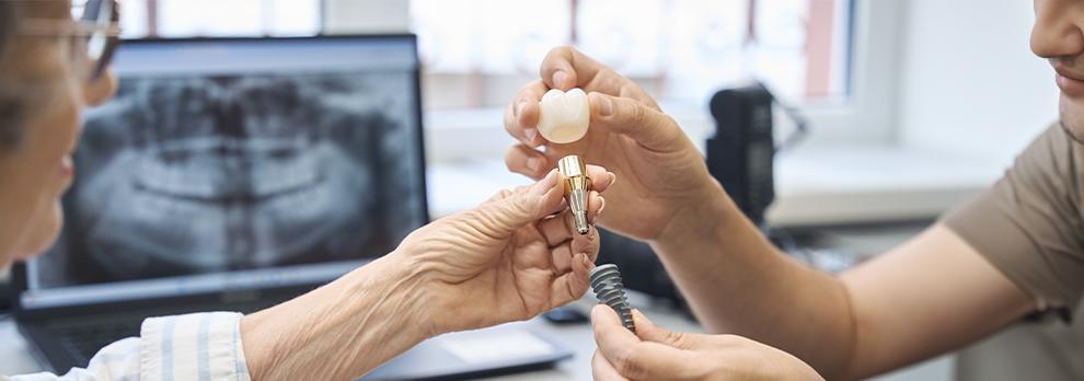 dentista mostrando implante dental