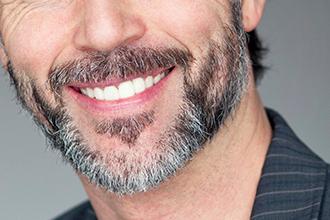 Implantes dentales