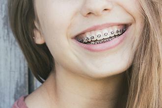 Ortodoncia brackets